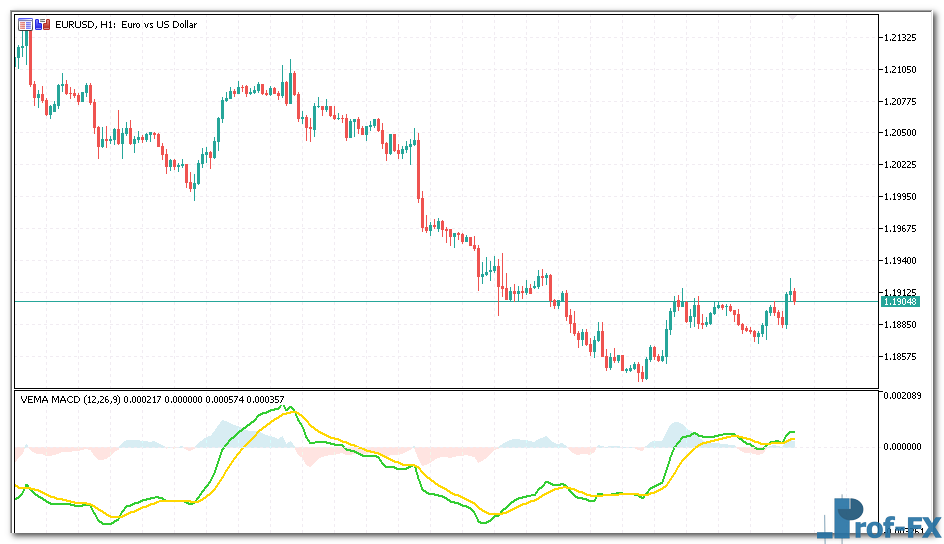VEMA MACD mt5 indicator